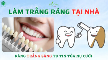 Làm trắng răng tại nhà giúp răng trắng sáng tự nhiên, nụ cười tự tin hơn