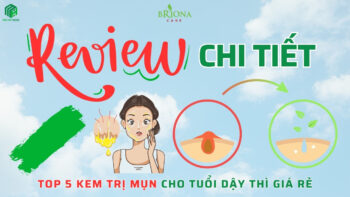 Top 5 Kem Trị Mụn Giá Rẻ Hiệu Quả Nhất Cho Tuổi Dậy Thì