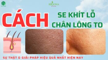 Cách Se Khít Lỗ Chân Lông To – Giải Pháp Thu Nhỏ Lỗ Chân Lông Hiệu Quả
