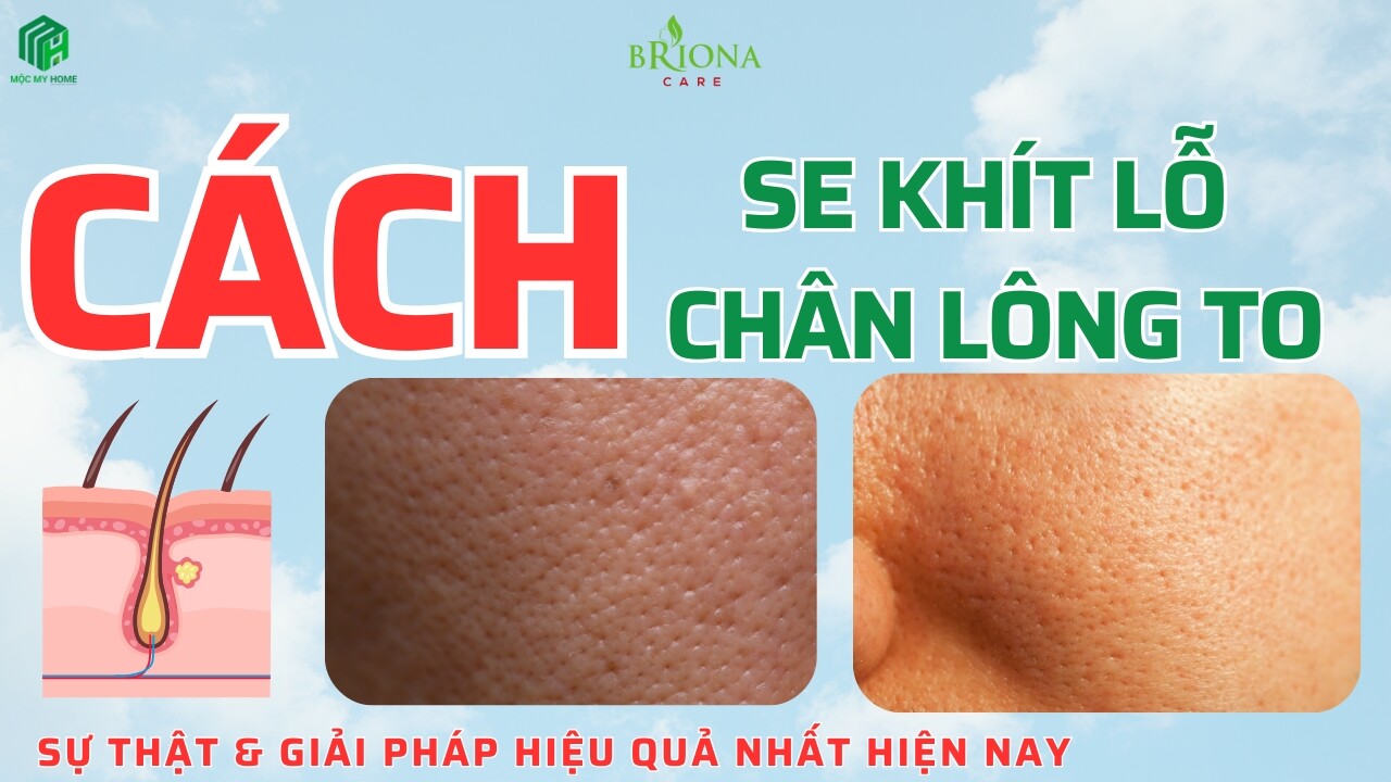 Bản sao của Bản sao của Bản sao của Bản sao của Blue Minimalist Clean New Serum Skincare Promotion Instagram Post (2200 x 949 px) (1200 x 630 px) (1280 x 720 px) (21) Cách se khít lỗ chân lông to vĩnh viễn giúp da mịn màng, thu nhỏ lỗ chân lông hiệu quả