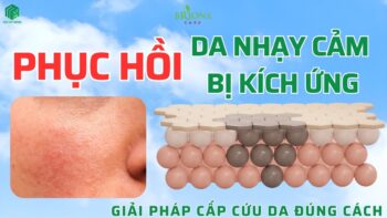 Phục hồi da nhạy cảm bị kích ứng giúp da khỏe mạnh, mịn màng