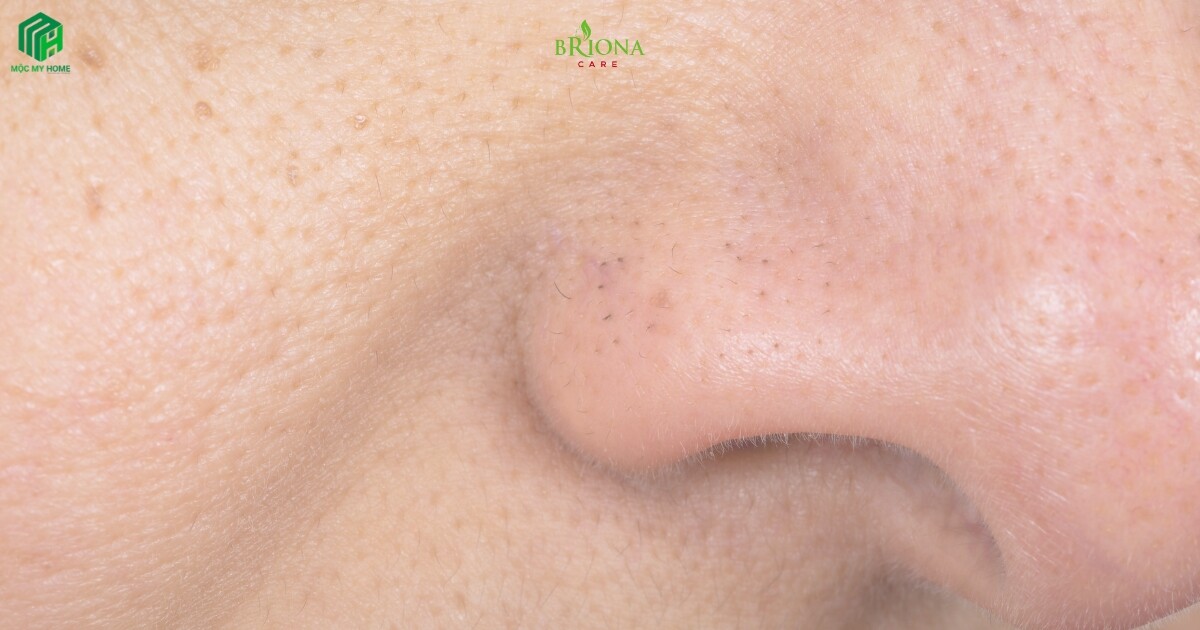 Bản sao của Bản sao của Bản sao của Blue Minimalist Clean New Serum Skincare Promotion Instagram Post (2200 x 949 px) (1200 x 630 px) 2025 06 08T153750.942 Cách Se Khít Lỗ Chân Lông To – Giải Pháp Thu Nhỏ Lỗ Chân Lông Hiệu Quả