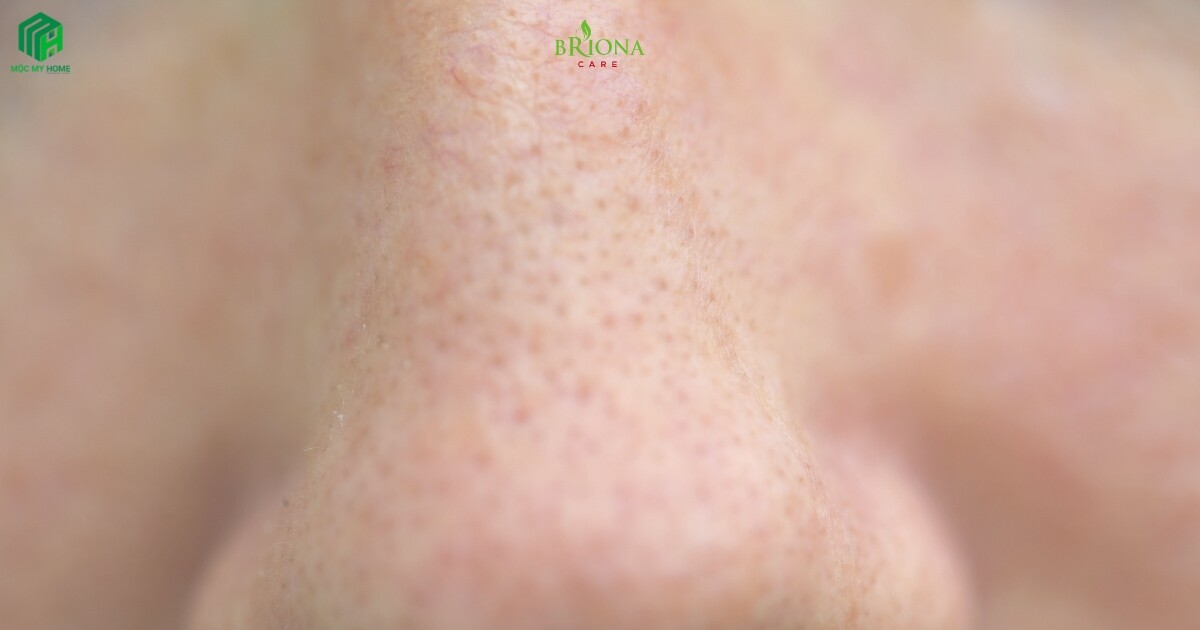 Bản sao của Bản sao của Bản sao của Blue Minimalist Clean New Serum Skincare Promotion Instagram Post (2200 x 949 px) (1200 x 630 px) 2025 06 08T153820.803 Cách se khít lỗ chân lông to giúp da mịn màng, thu nhỏ lỗ chân lông hiệu quả